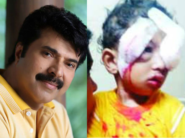 mammooty-dog-attack mammooty-dog-attack