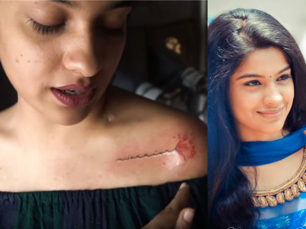 ഇടത് തോളില് കുത്തി