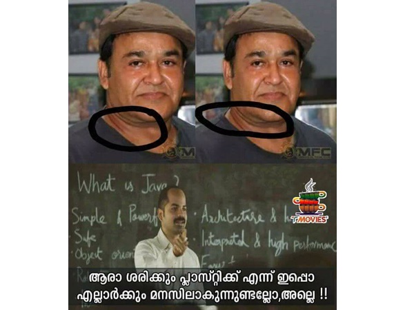 പ്ലാസ്റ്റിക് സര്ജറിയോ?